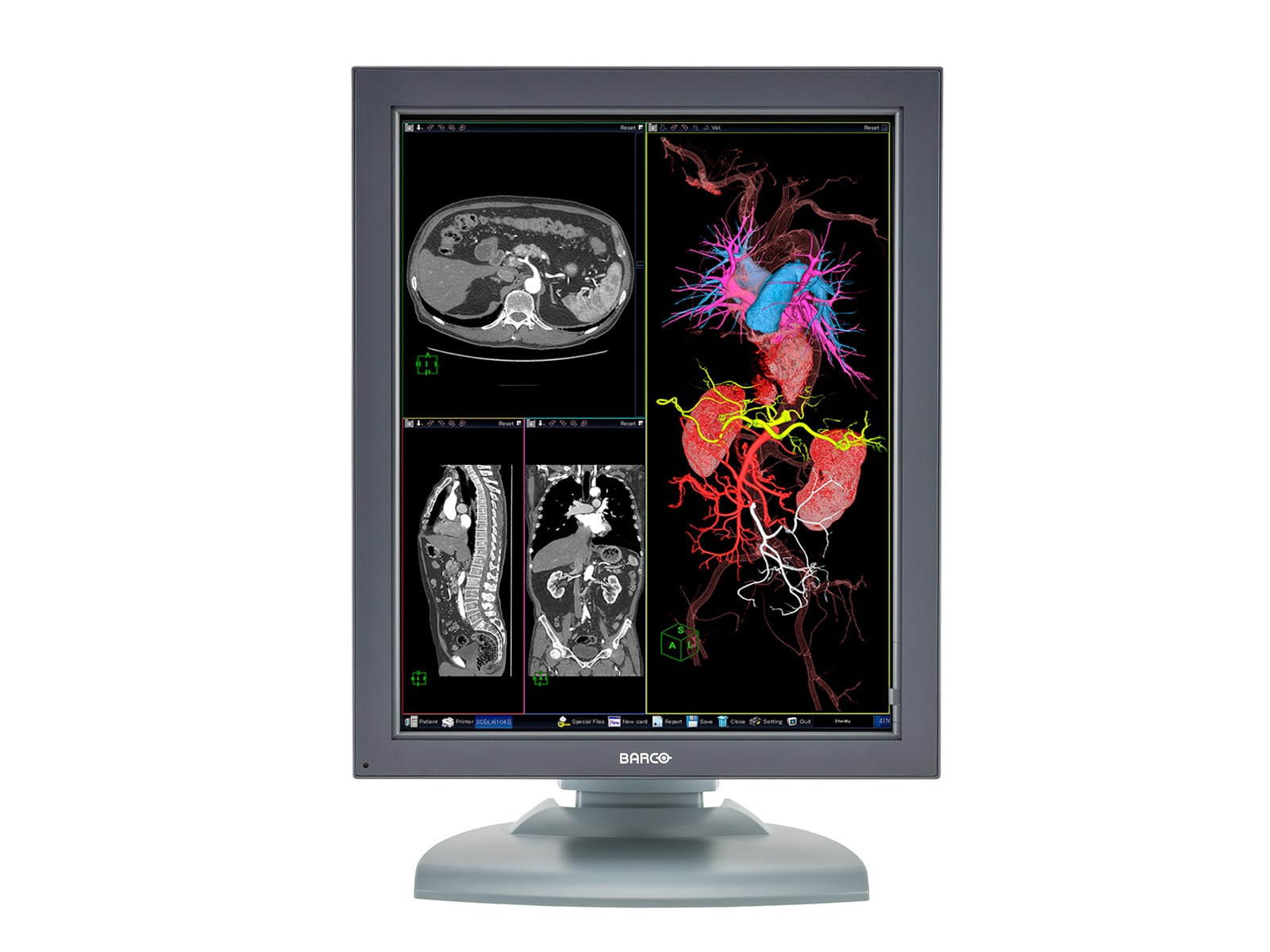 Barco Nio MDNC-3121 HighBright 3MP 21" Color Medical Diagnostic Radiology Monitor Monitors.com 