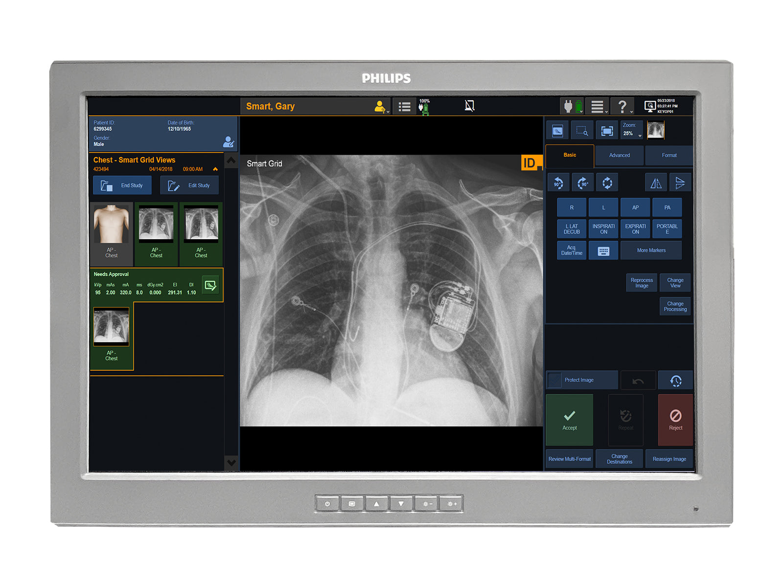 Barco P240-LAv MED24ESB 24" 2MP Philips DICOM Surgical Display Monitor by Fimi Barco (P240-LAv)