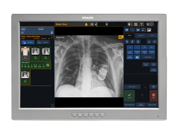 Barco P240-LAv MED24ESB 24" 2MP Philips DICOM Surgical Display Monitor by Fimi Barco (P240-LAv)