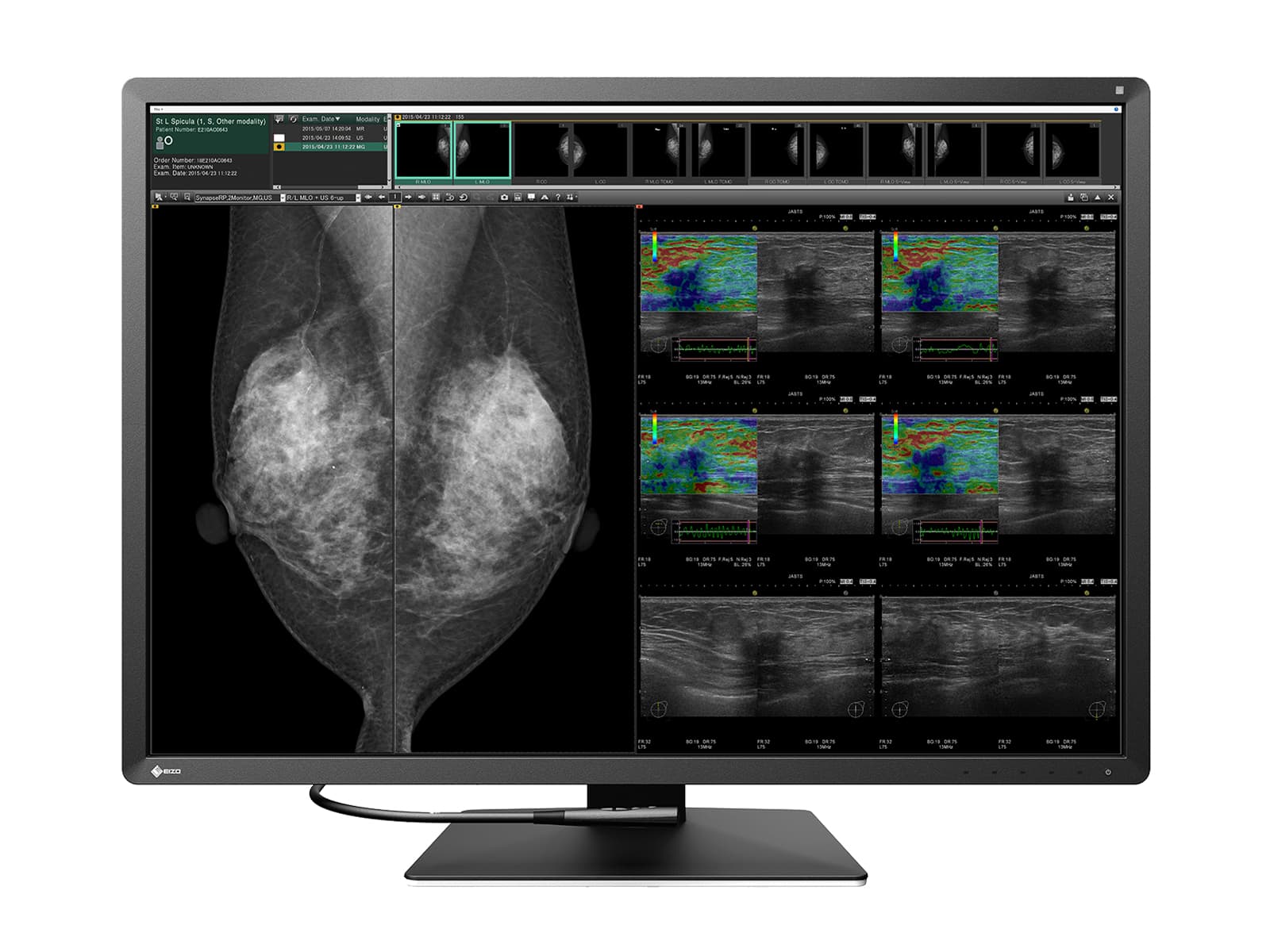 Estación completa de lectura de mamografía | Pantalla Eizo | Estación de trabajo Lenovo (RX1270P520) Monitors.com