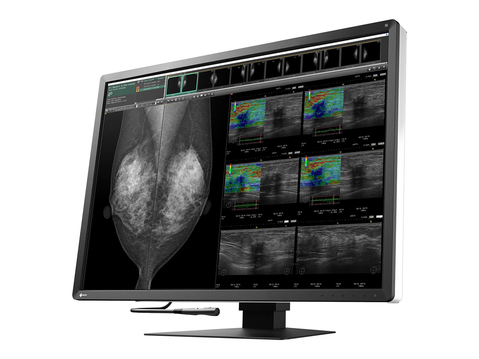 Eizo Radiforce RX1270 12MP 31" Tomo Έγχρωμη Οθόνη LED Mammo 3D DBT PACS (RX1270)