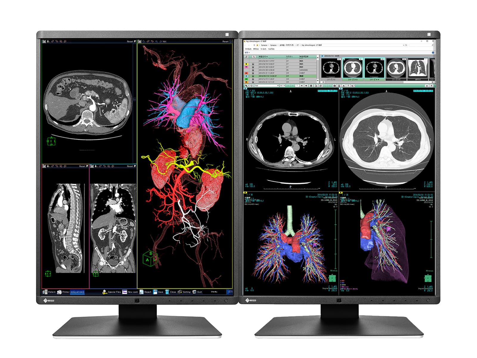 Eizo RadiForce RX350 3MP 21" Color LED General Radiology Diagnostic Display (RX350) Monitors.com 