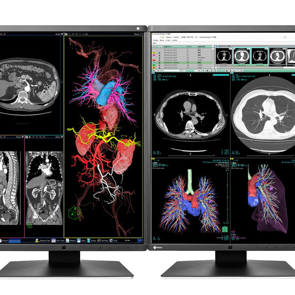 EIZO RadiForce RX440 29.8型液晶モニ　WQXGA Eizo RadiForce RX440 4MP 30