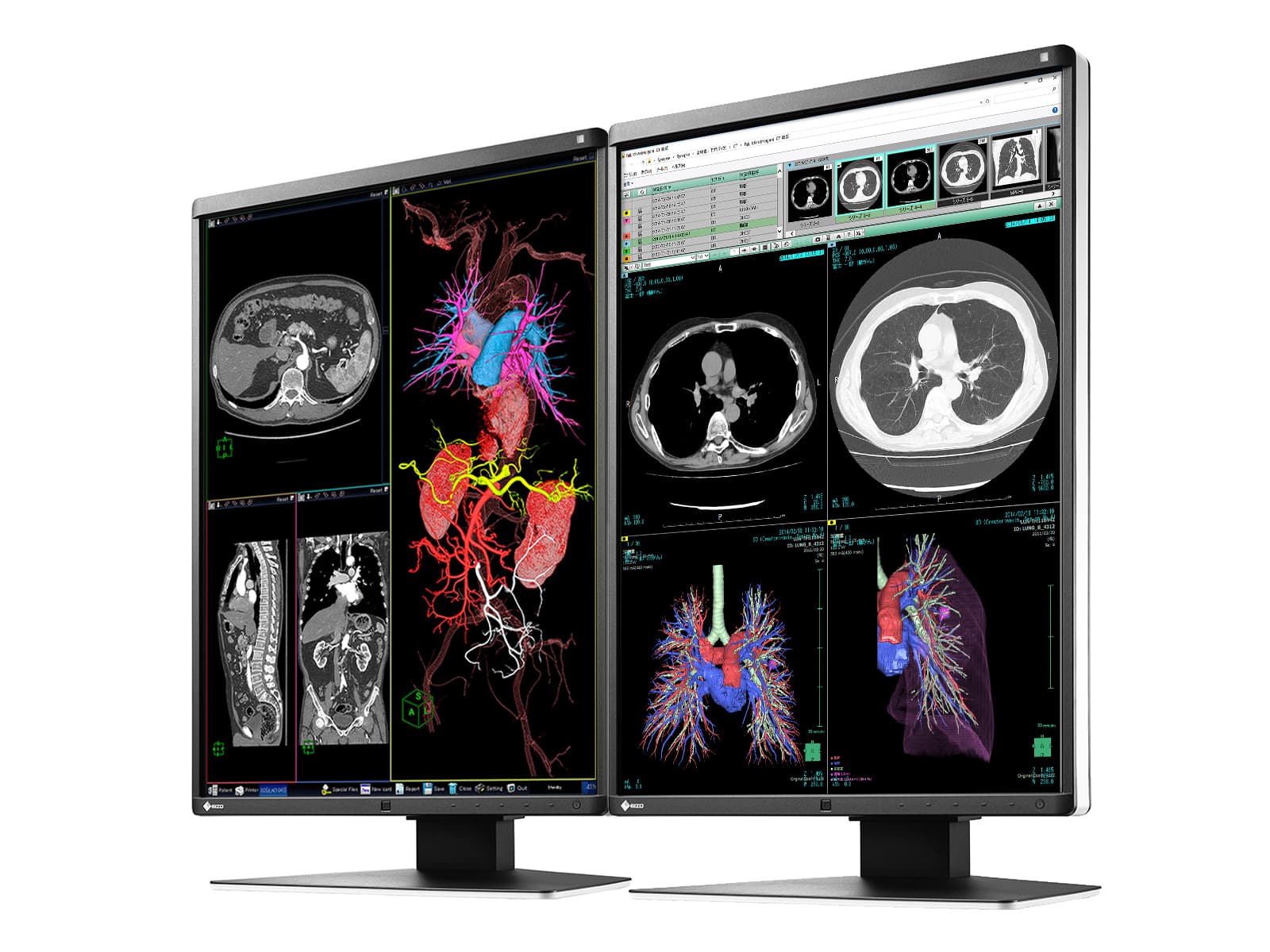 Eizo RadiForce RX350 3MP 21" Farb-LED-Diagnosedisplay für allgemeine Radiologie (RX350) Monitors.com