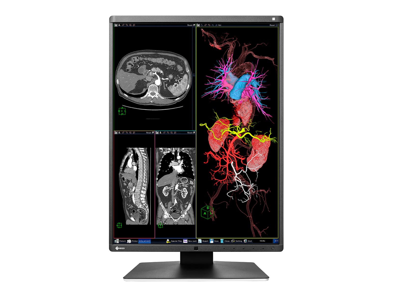 Eizo RadiForce RX350 3MP 21" Farb-LED-Diagnosedisplay für allgemeine Radiologie (RX350) Monitors.com