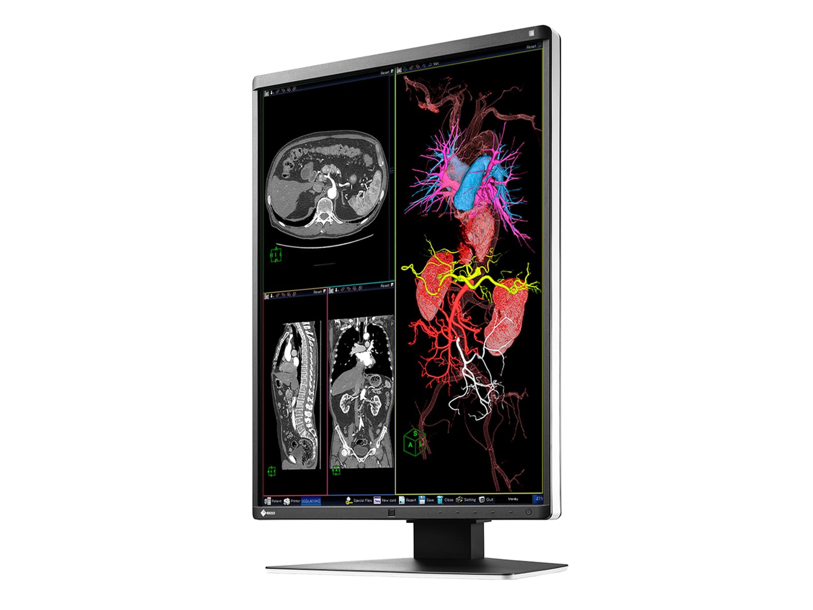 Eizo RadiForce RX350 Pantalla de diagnóstico de radiología general LED en color de 3 MP y 21" (RX350) Monitors.com