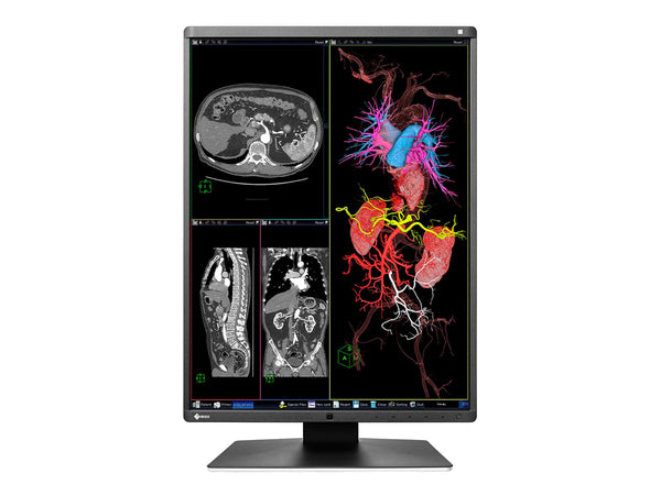 Eizo RadiForce RX360 3MP 21