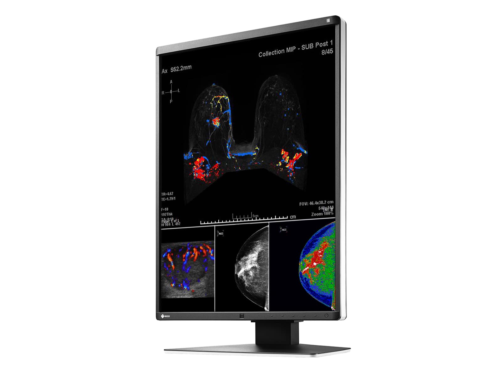 Eizo RadiForce RX560 5MP 21" Color LED Mammo 3D-DBT Breast Imaging Display (RX560-BK)