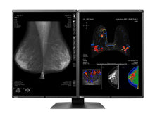 Eizo RadiForce RX560 5MP 21" LED a colori Mammo 3D-DBT Display per l'imaging del seno (RX560-BK)