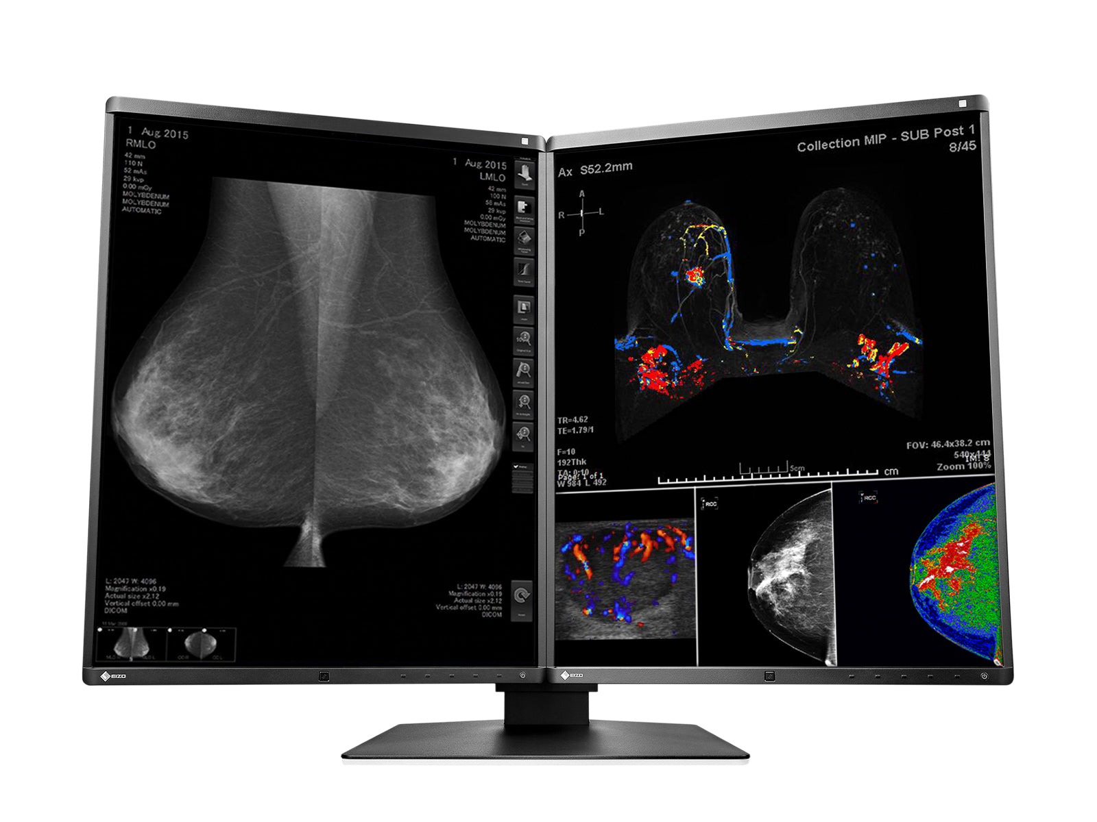 Eizo RadiForce RX560 5MP 21