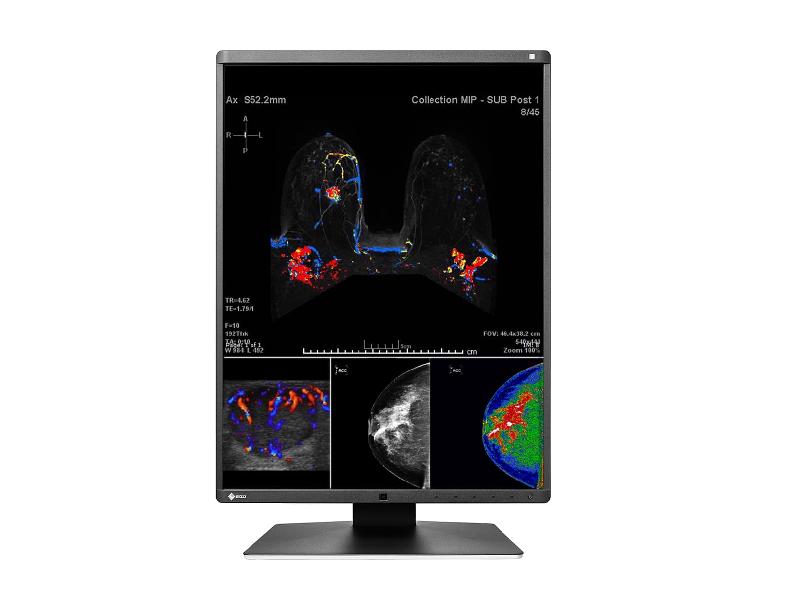 Eizo RadiForce RX560 5MP 21" Farb-LED Mammo 3D-DBT Brustbildgebungsdisplay (RX560-BK) Monitore.com