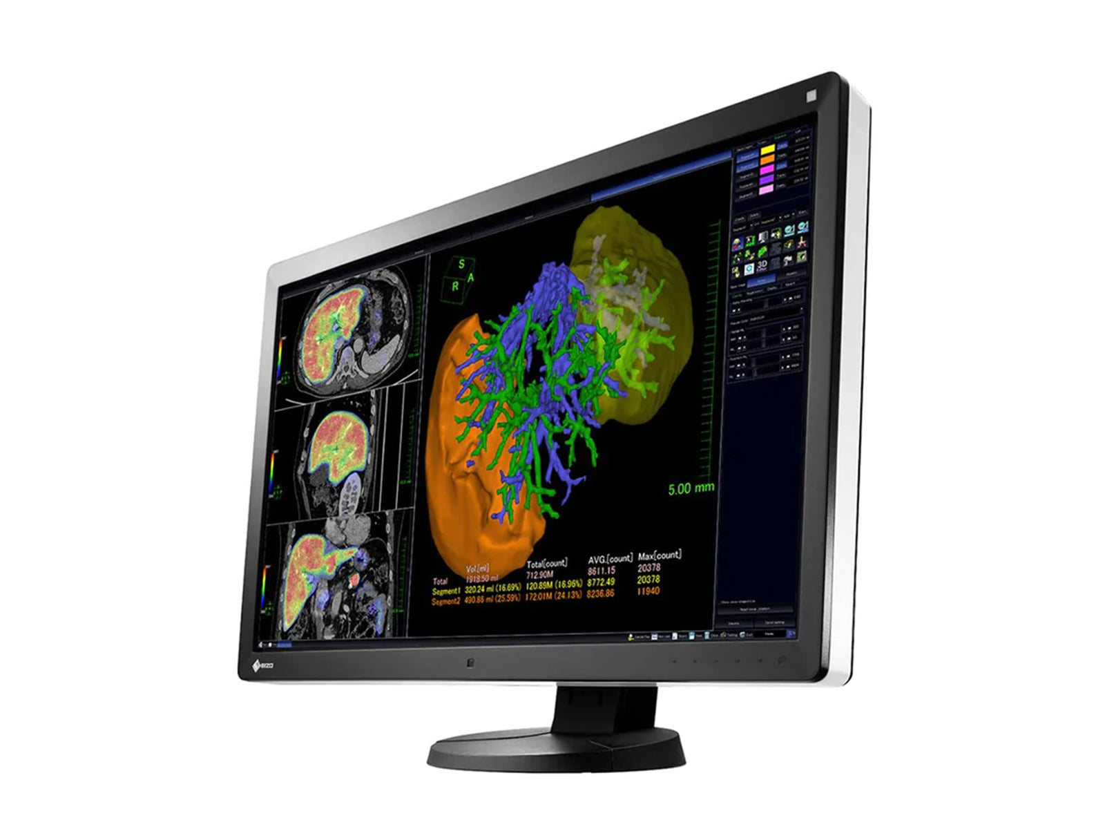 Eizo RadiForce RX650 6MP 30" Farb-LED-PACS-Display für allgemeine Radiologie (RX650) Monitors.com