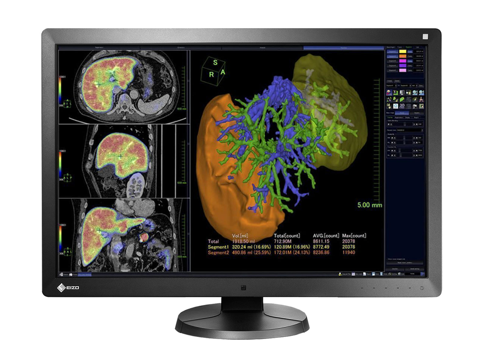 Eizo RadiForce RX650 6MP 30" Color LED General Radiology PACS Display (RX650)