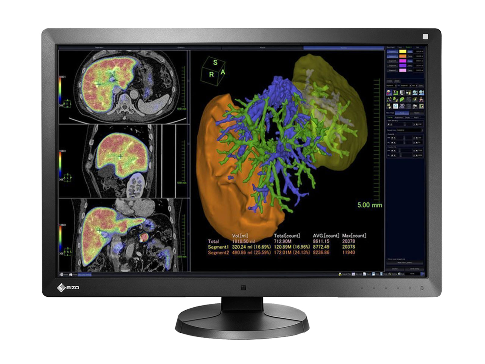 Eizo RadiForce RX650 6MP 30" Farb-LED-PACS-Display für allgemeine Radiologie (RX650) Monitors.com