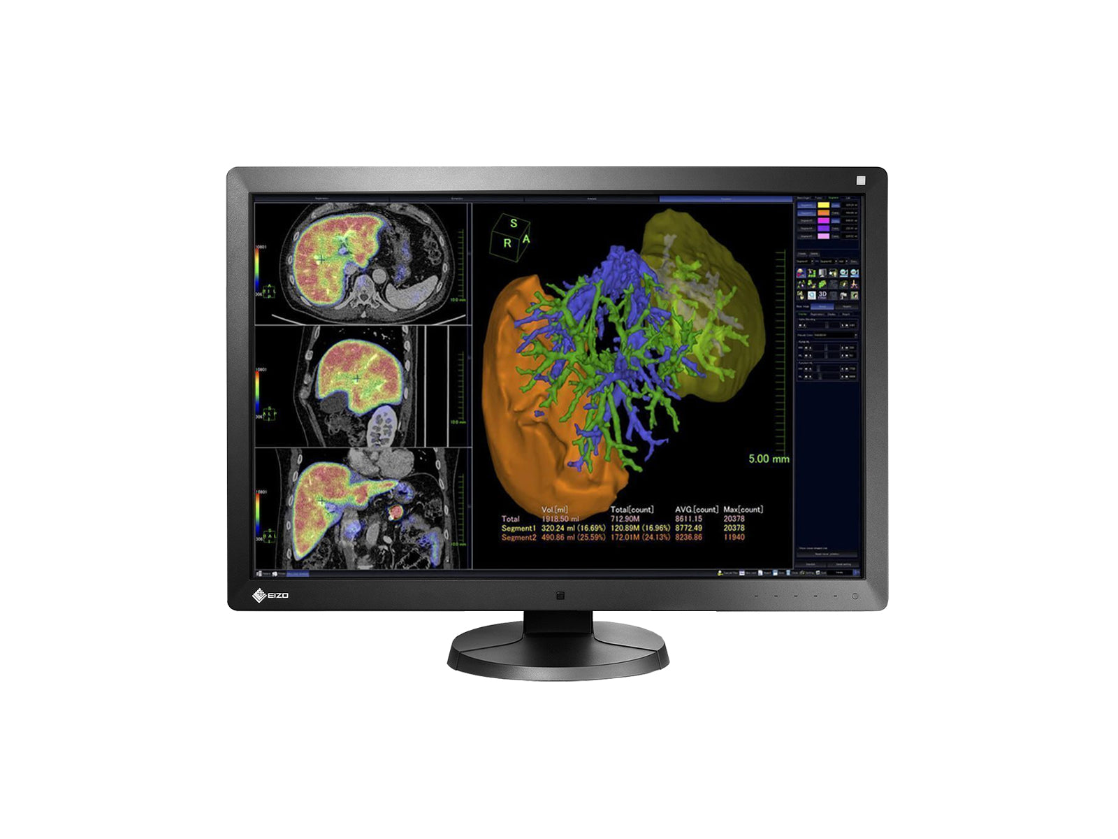 Complete PACS General Radiology Station | Eizo 6MP Color LED Displays | Dell Workstation | Dictation Mic | Worklist Monitor (RX6505820R) Monitors.com 