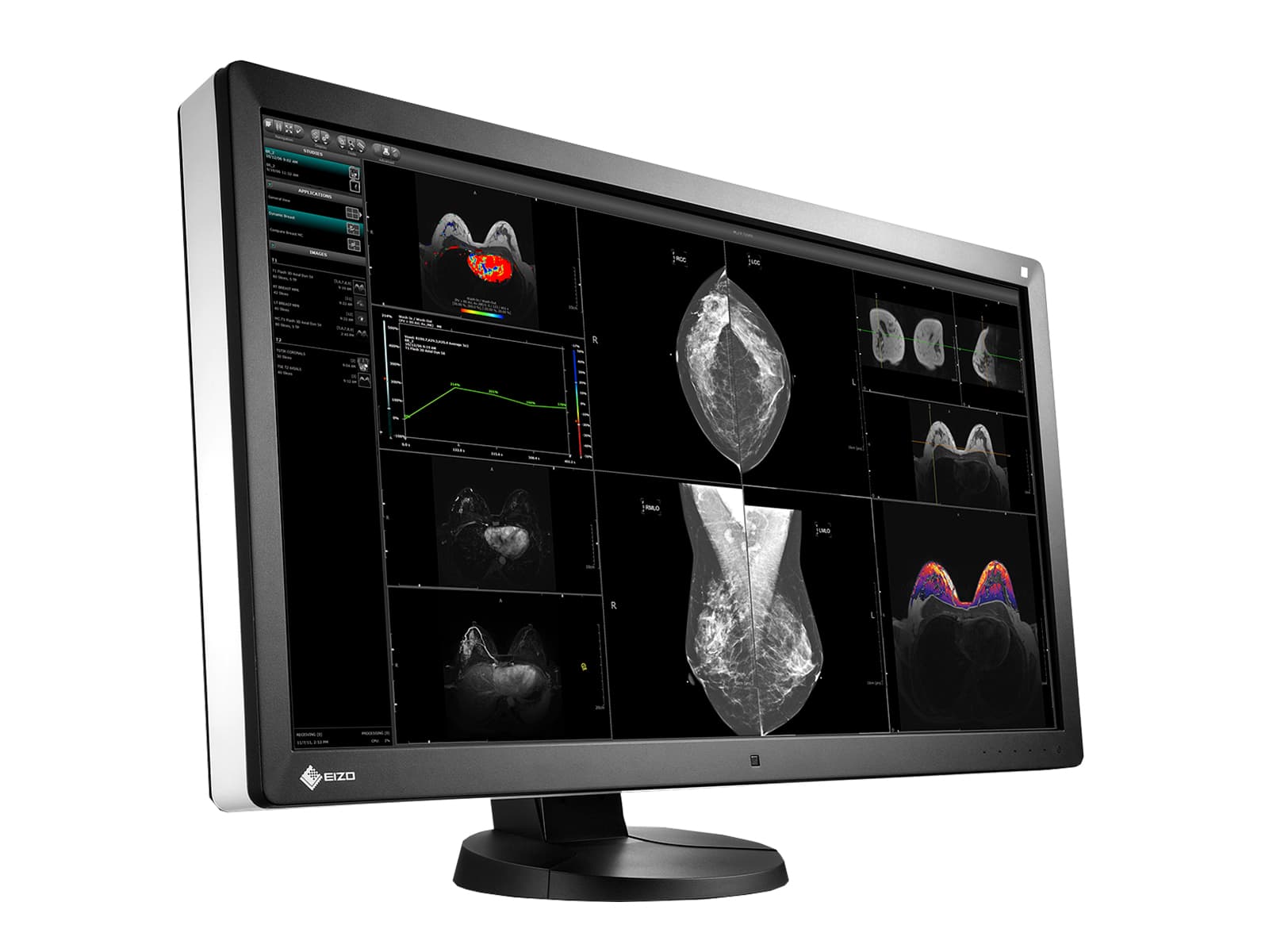 Eizo RadiForce RX850 8MP 31" Fusion Color LED Mammo 3D-DBT Display per l'imaging del seno (RX850-BK)