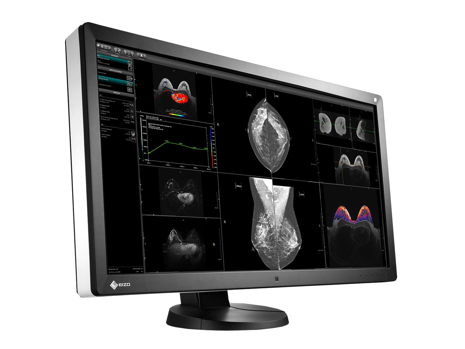 Eizo RadiForce RX850 Fusion Color LED Mammo 3D-DBT Brustbildgebungsdisplay (RX850-BK) Monitore.com