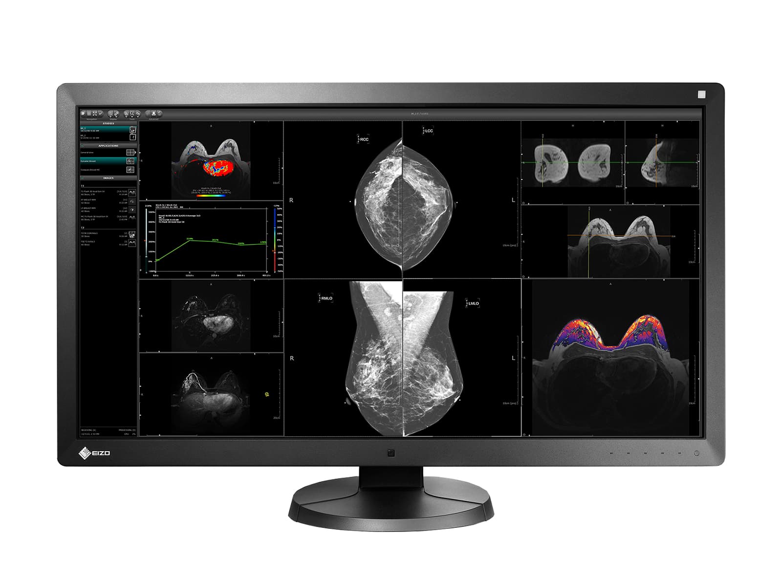 Pantalla de imágenes mamarias Eizo RadiForce RX850 Fusion Color LED Mammo 3D-DBT (RX850-BK) Monitors.com