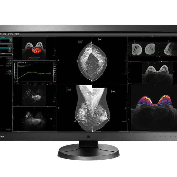 EIZO RadiForce RX440 29.8寸 使用时间　15486H Eizo RadiForce RX440 4MP 30