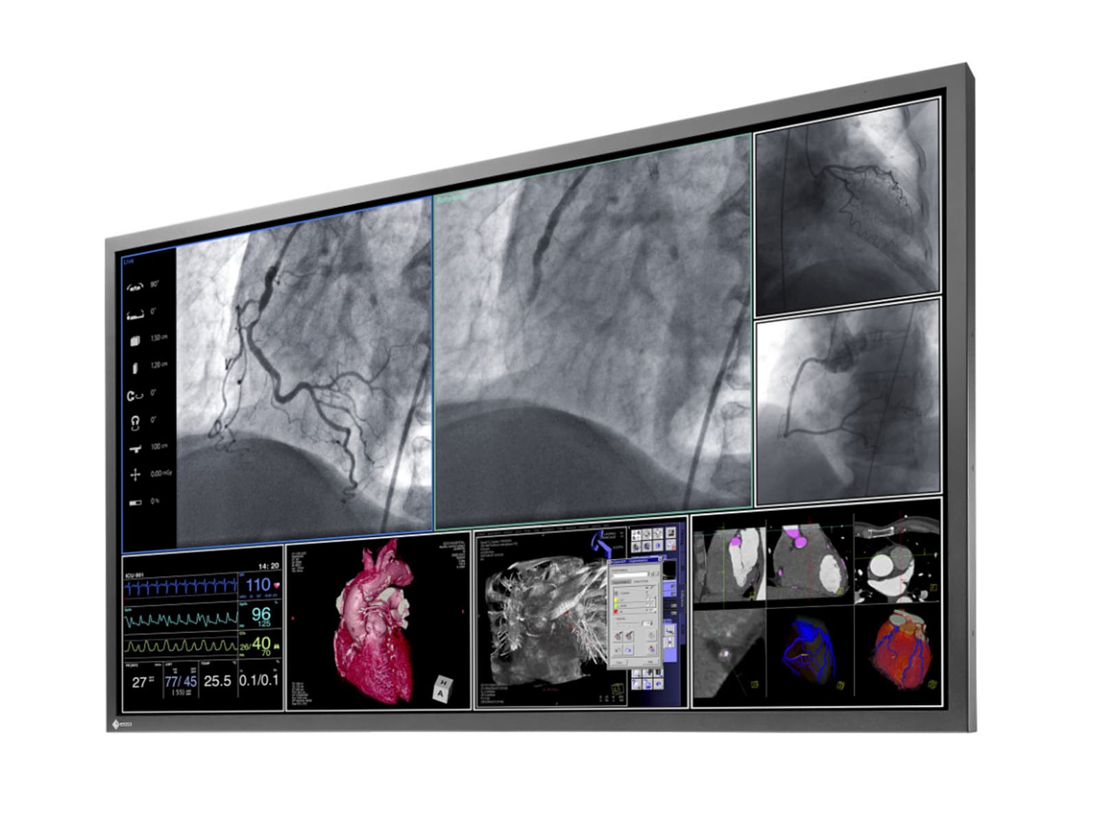 Eizo RadiForce LS580W: 4K Surgical Display Monitor