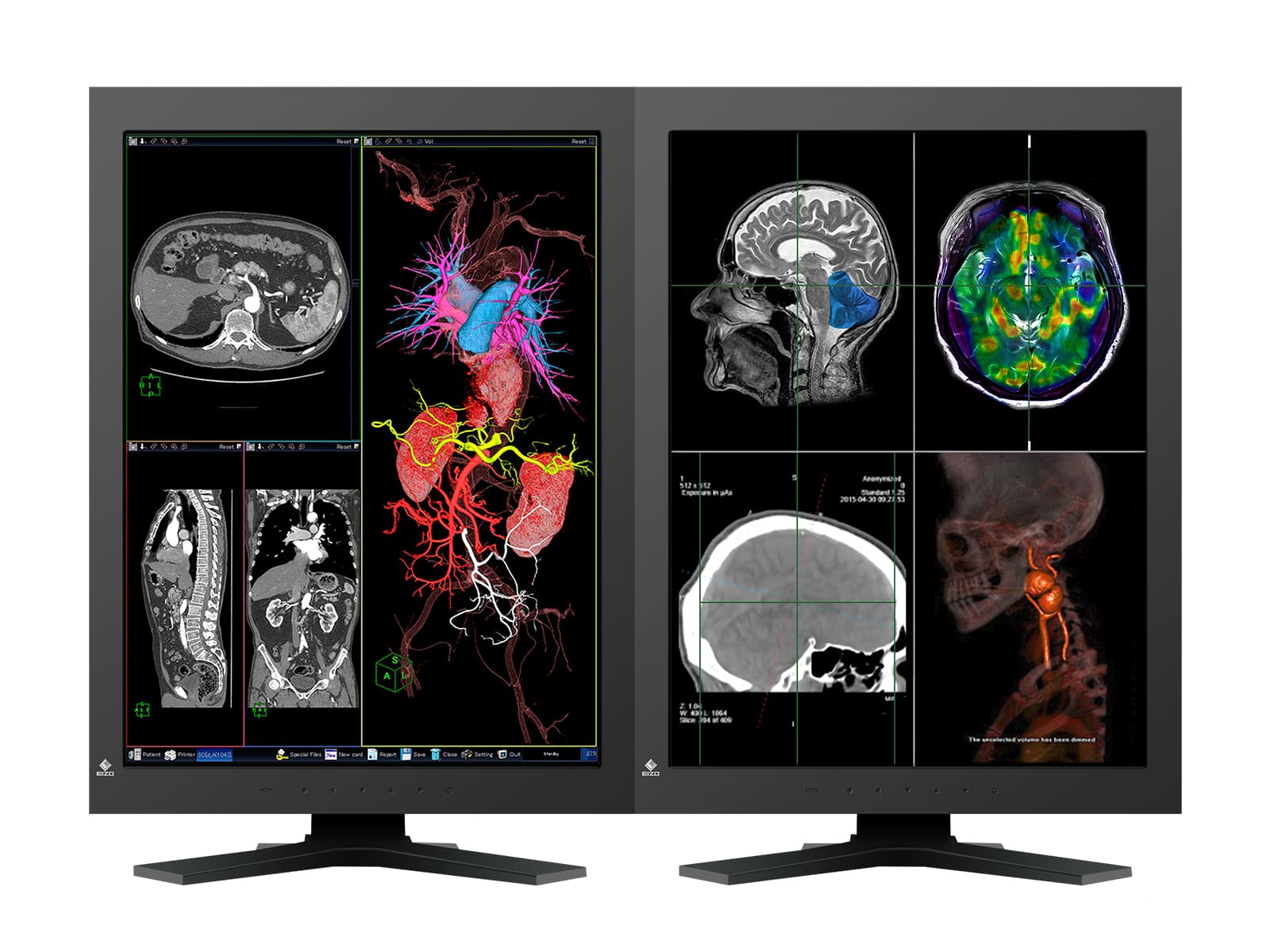 Eizo Radiforce RX320 3MP 21" Farb-LCD-Display für allgemeine Radiologie-Diagnose (RX320) Monitors.com