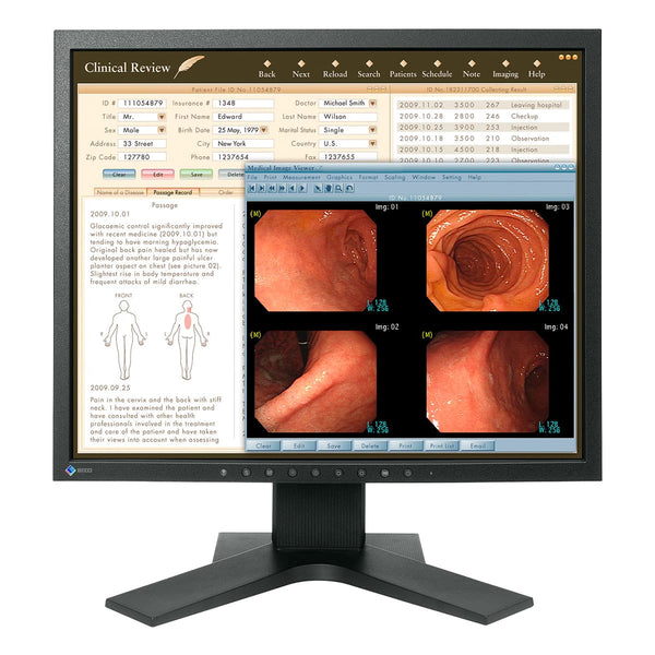 Eizo MX194 1MP Clinical Review Monitor Display