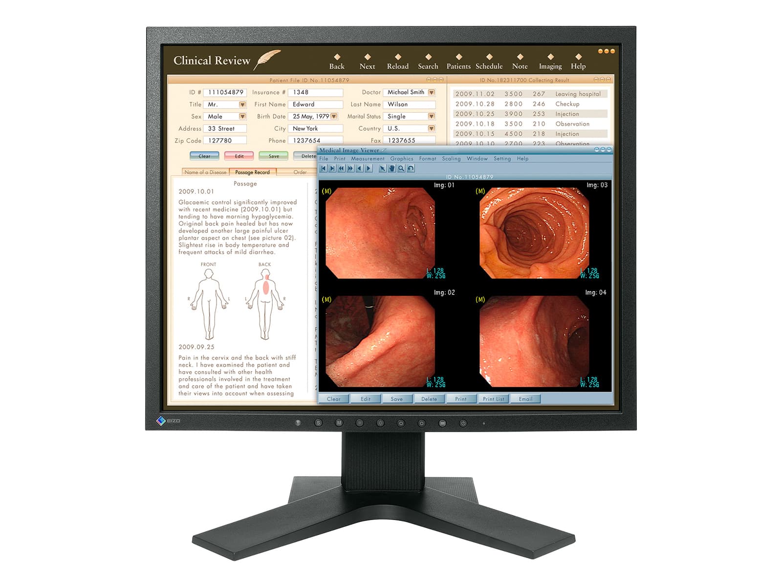 Eizo RadiForce MX191 1MP 19-Zoll-Farbmonitor für klinische Tests (MX191) Monitors.com