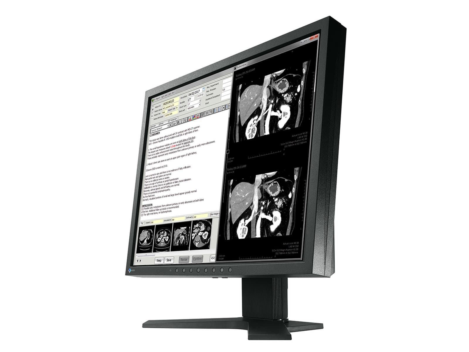 Monitor de revisión clínica en color Eizo RadiForce MX191 de 1 MP y 19" (MX191) Monitors.com