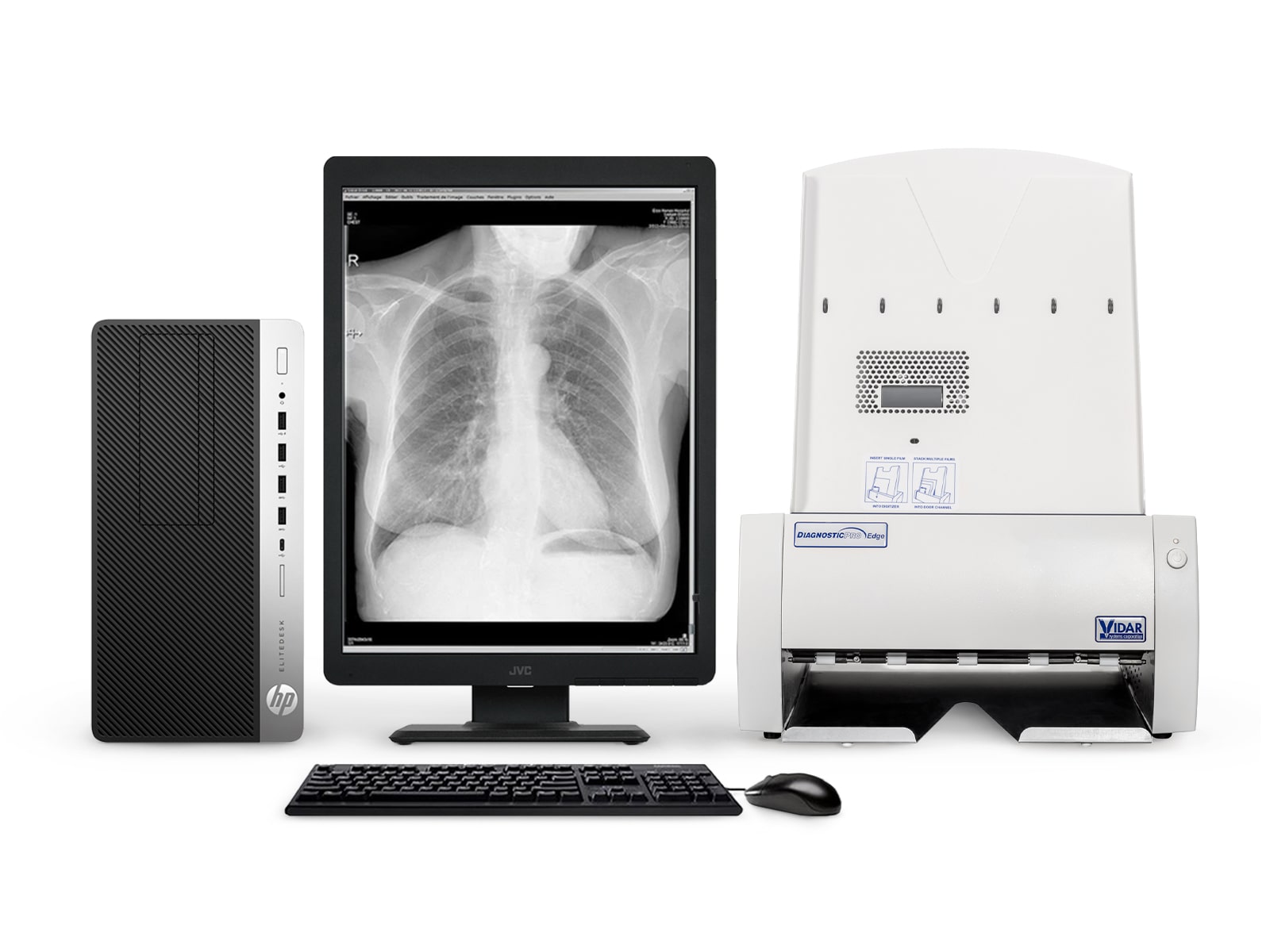Vidar DiagnosticPro Edge Radiología general y mamografía Digitalizador de película (19580-001) Monitors.com