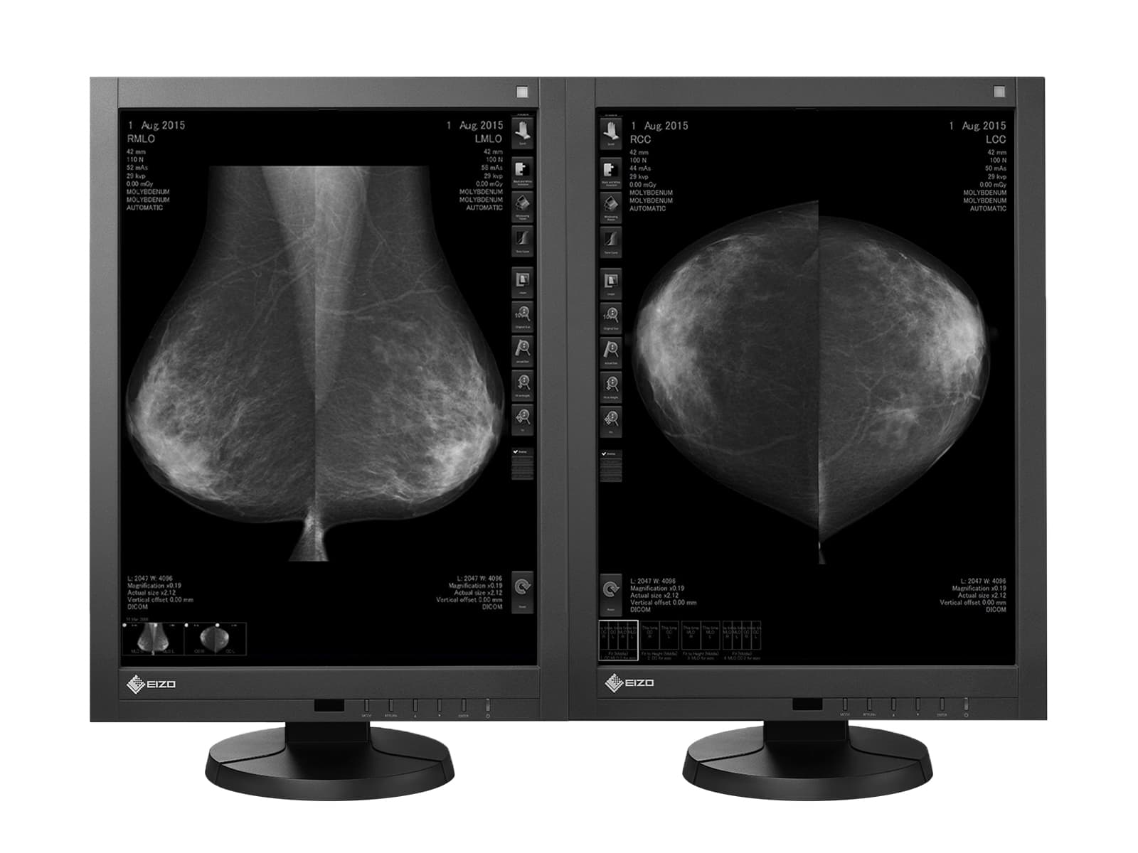 Eizo RadiForce GX540 5MP 21" Écran de mammographie numérique LED en niveaux de gris 3D-DBT (GX540-CL)