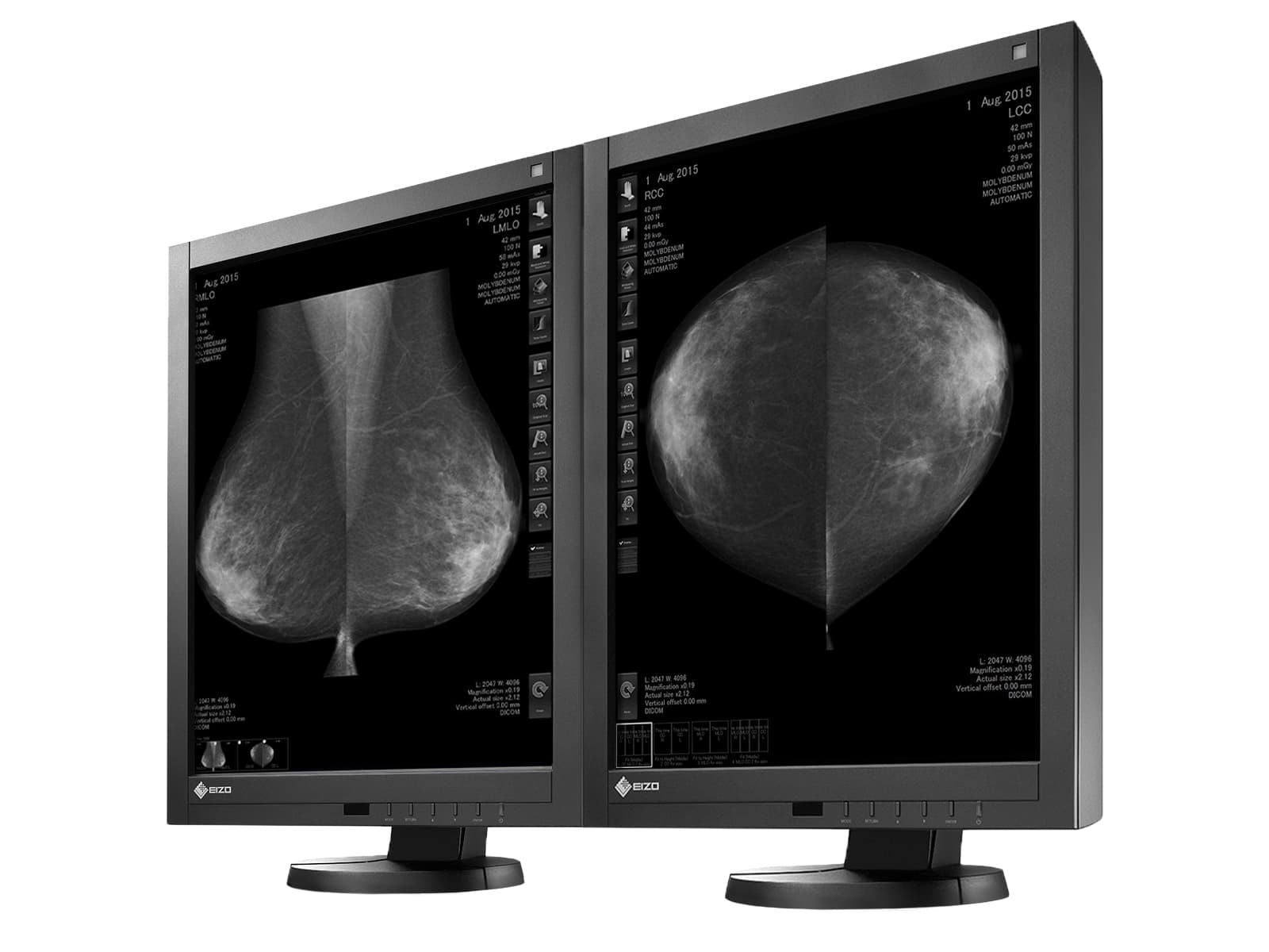 Eizo RadiForce GX540 5MP 21" Grayscale LED Digital Mammography 3D-DBT Display (GX540-CL) Monitors.com 