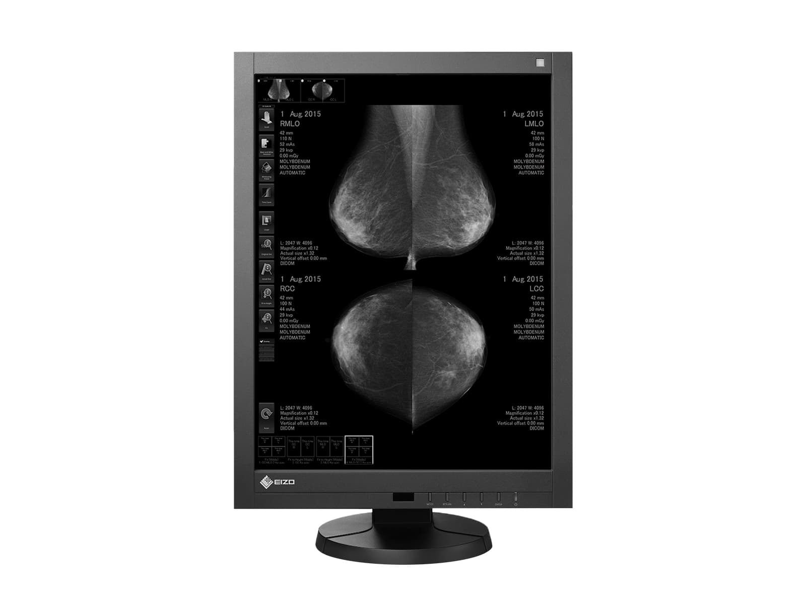 Eizo RadiForce GX540 5MP 21" Grayscale LED Digital Mammography 3D-DBT Display (GX540-CL) Monitors.com 
