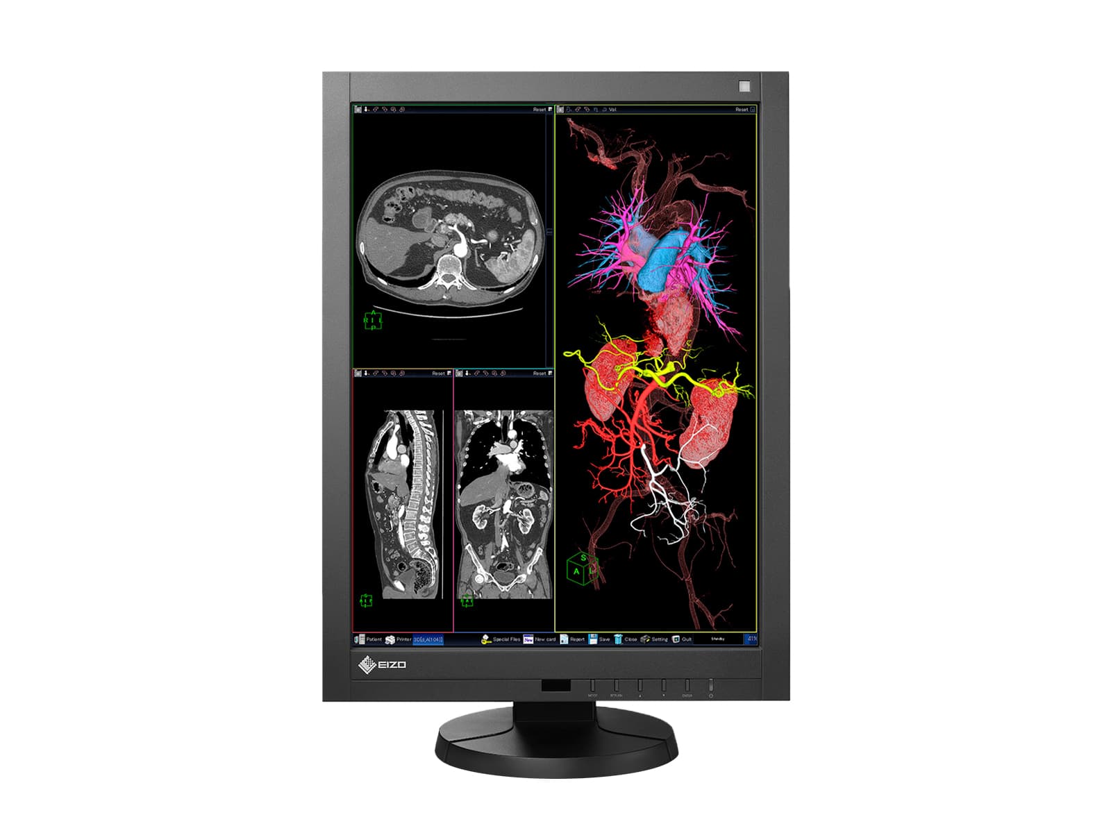 Eizo Radiforce RX340 Farb-LED-PACS-Display für allgemeine Radiologie-Diagnose (RX340-BK) Monitors.com