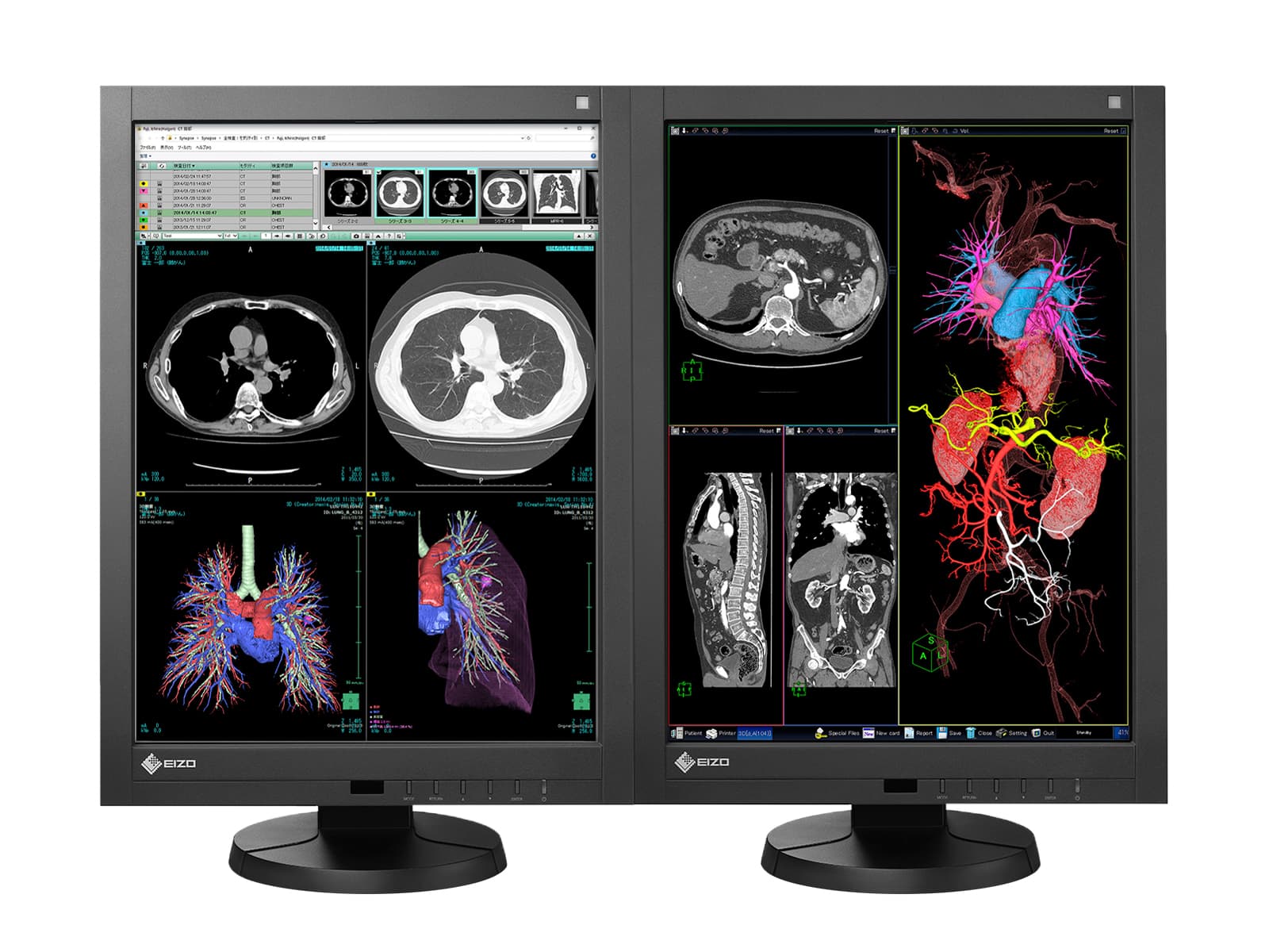 Pantalla PACS de diagnóstico de radiología general LED en color Eizo Radiforce RX340 (RX340-BK) Monitors.com