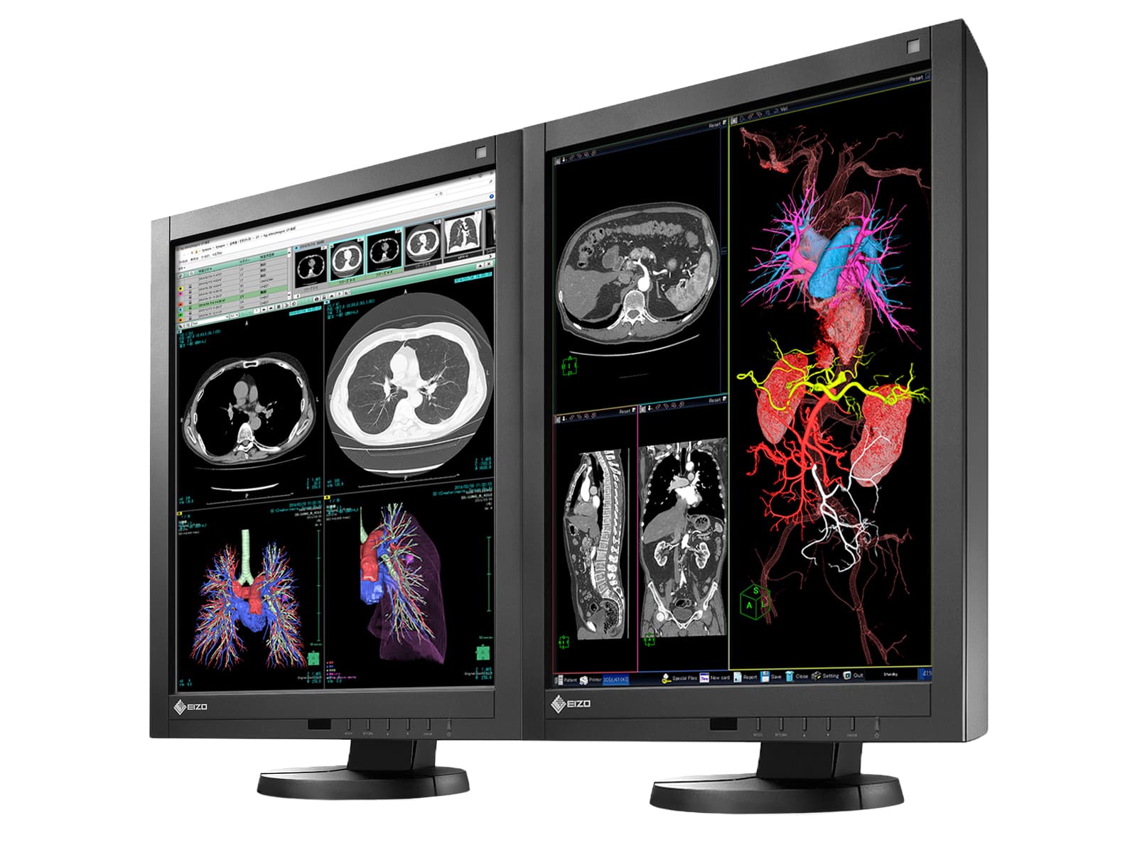 Eizo Radiforce RX340 Farb-LED-PACS-Display für allgemeine Radiologie-Diagnose (RX340-BK) Monitors.com