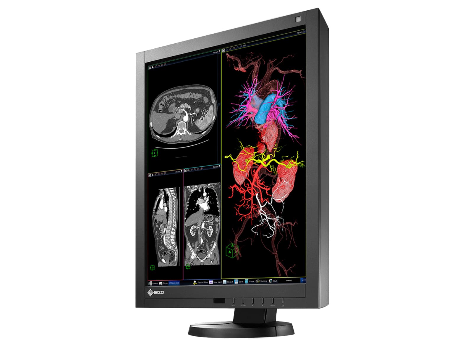 Eizo Radiforce RX340 Farb-LED-PACS-Display für allgemeine Radiologie-Diagnose (RX340-BK) Monitors.com