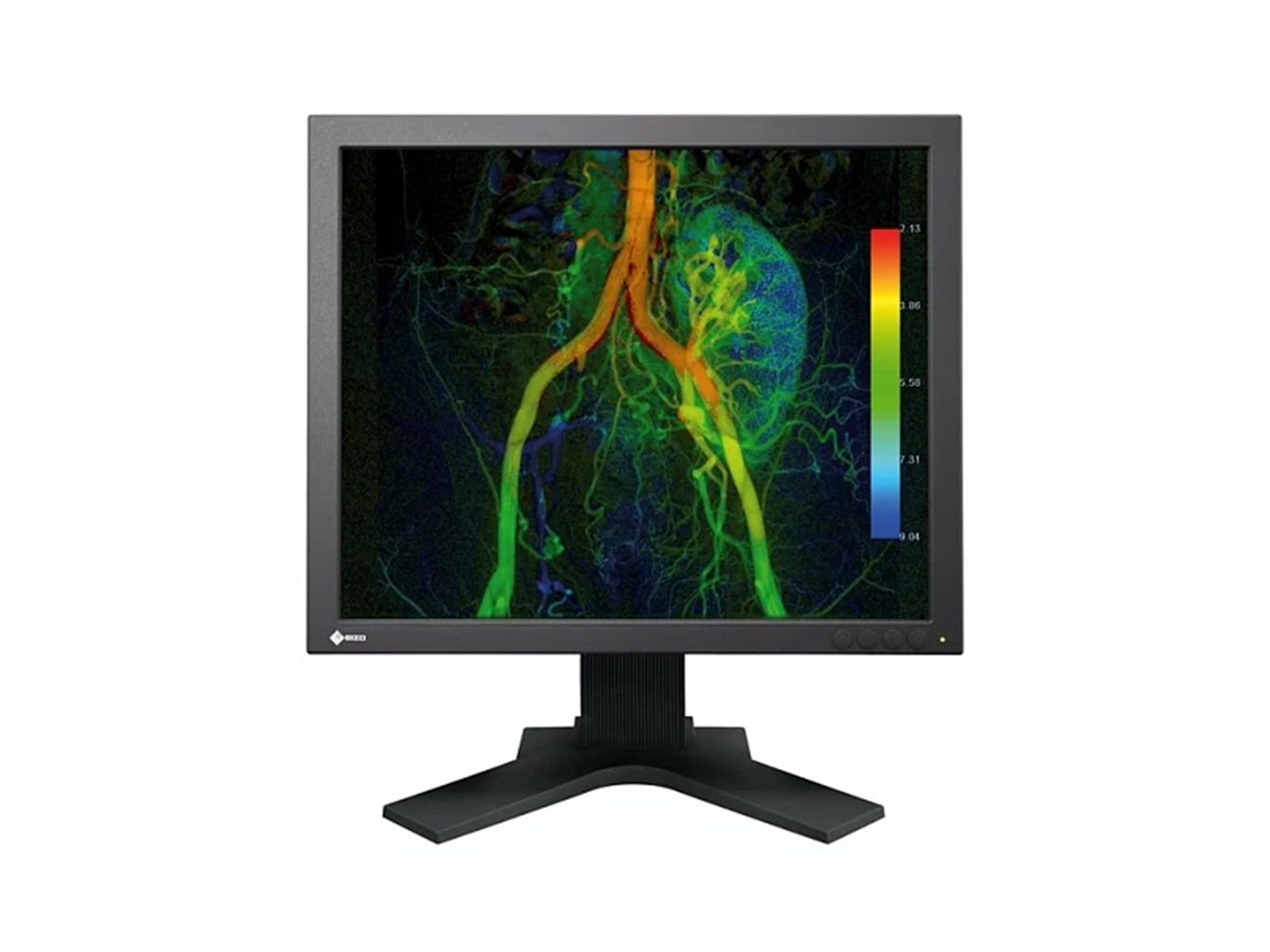 Eizo CuratOR EX190 1MP 19" LCD Color Surgical Medical Display Monitor (EX190-S) Monitors.com 