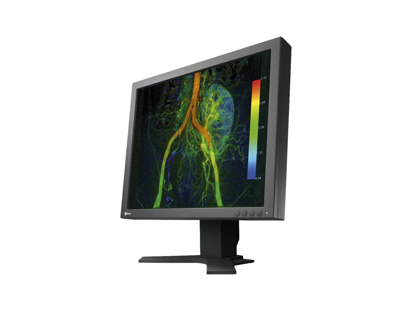 Eizo CuratOR EX190 1MP 19" LCD Color Surgical Medical Display Monitor (EX190-S) Monitors.com 