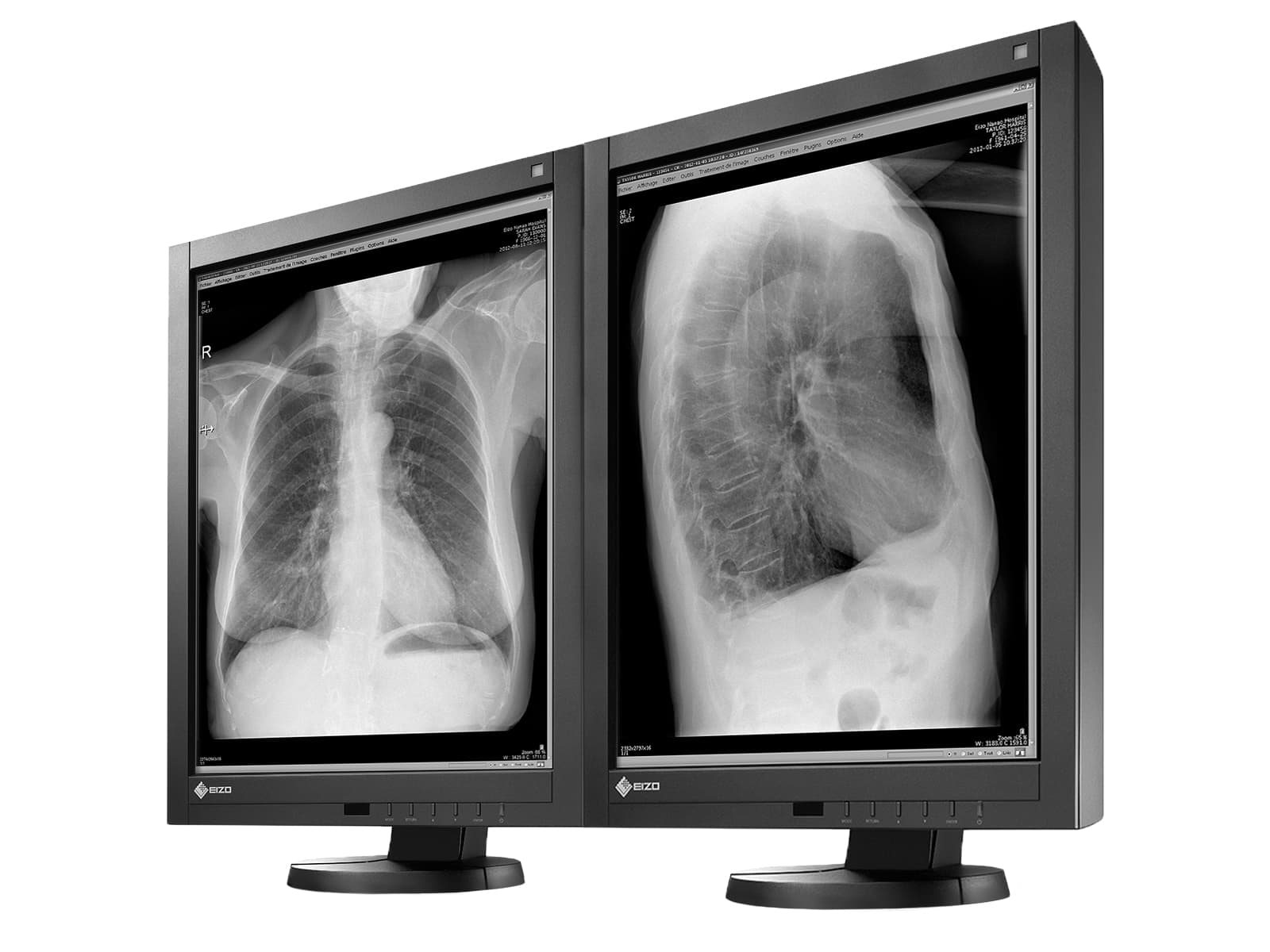 Eizo RadiForce GX340 3MP 21" Grayscale LED General Radiology Diagnostic Display Monitor (GX340-CL) Monitors.com 