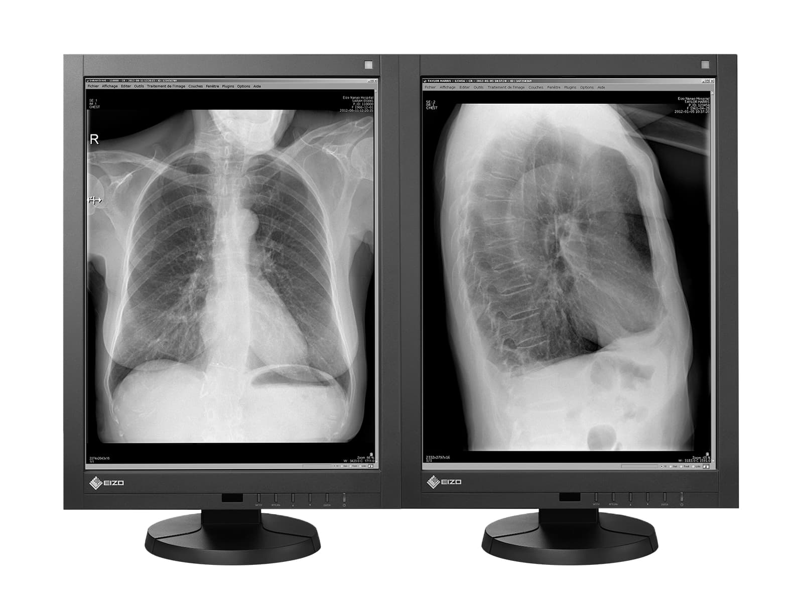 Eizo RadiForce GX340 3MP 21" Moniteur d'affichage de diagnostic de radiologie générale LED en niveaux de gris (GX340-CL)