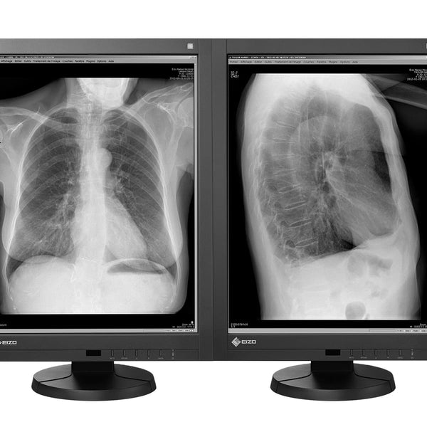 【高精細】未使用品　モニター21.2インチ　EIZO GX340 Eizo RadiForce GX340 3MP Grayscale Diagnostic Display (GX340-CL)