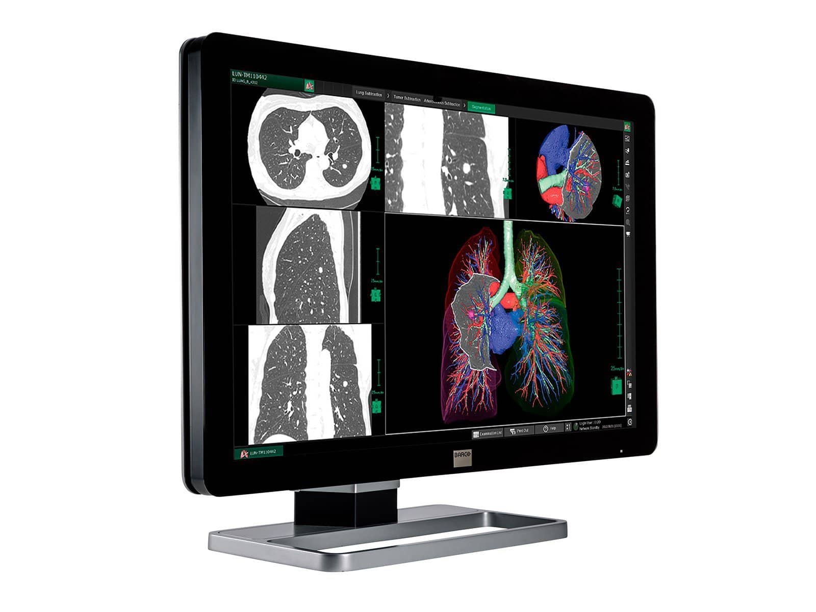Barco Coronis Fusion MDCC-6330 6MP 30" Color LED General Radiology PACS Display