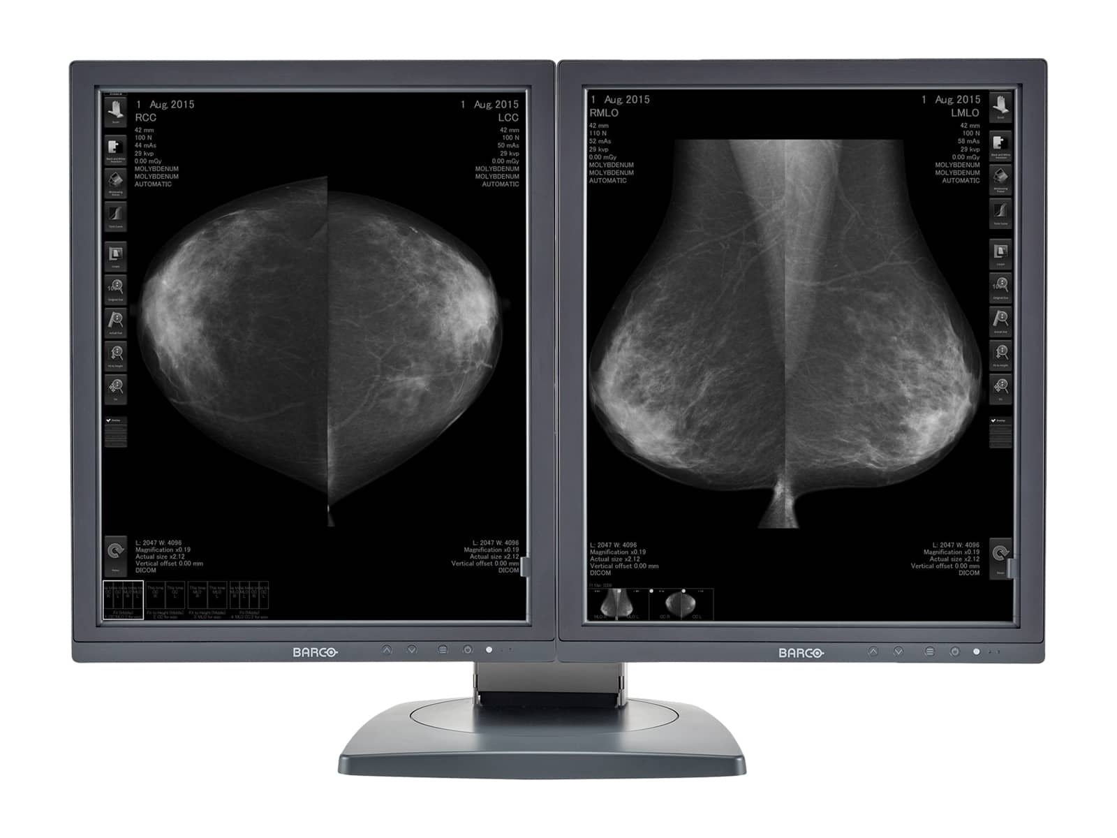 Barco Écran d'imagerie mammaire Coronis MDCG-5121 21" en niveaux de gris Mammo 3D-DBT (K9601738) Monitors.com