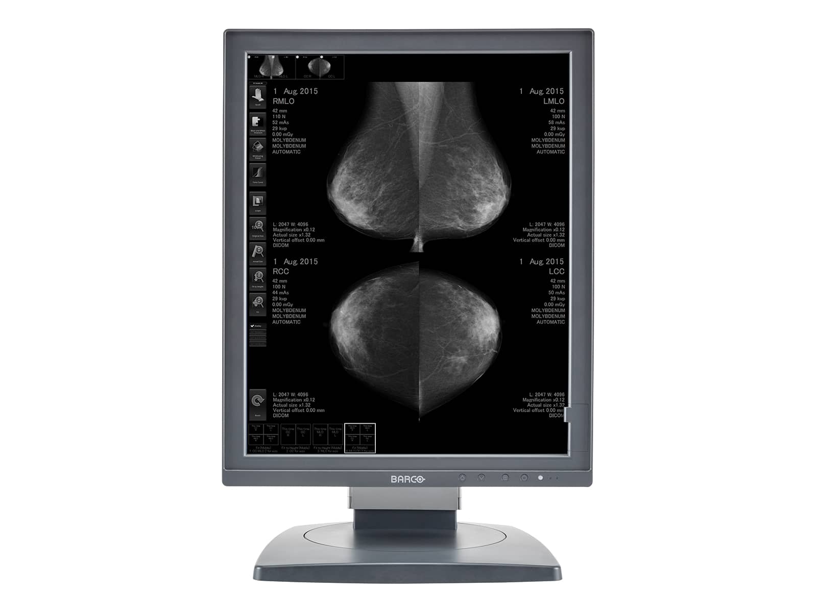 Barco Coronis MDCG-5121 5MP 21" Grayscale Mammo 3D-DBT Breast Imaging Display Monitor Monitors.com 