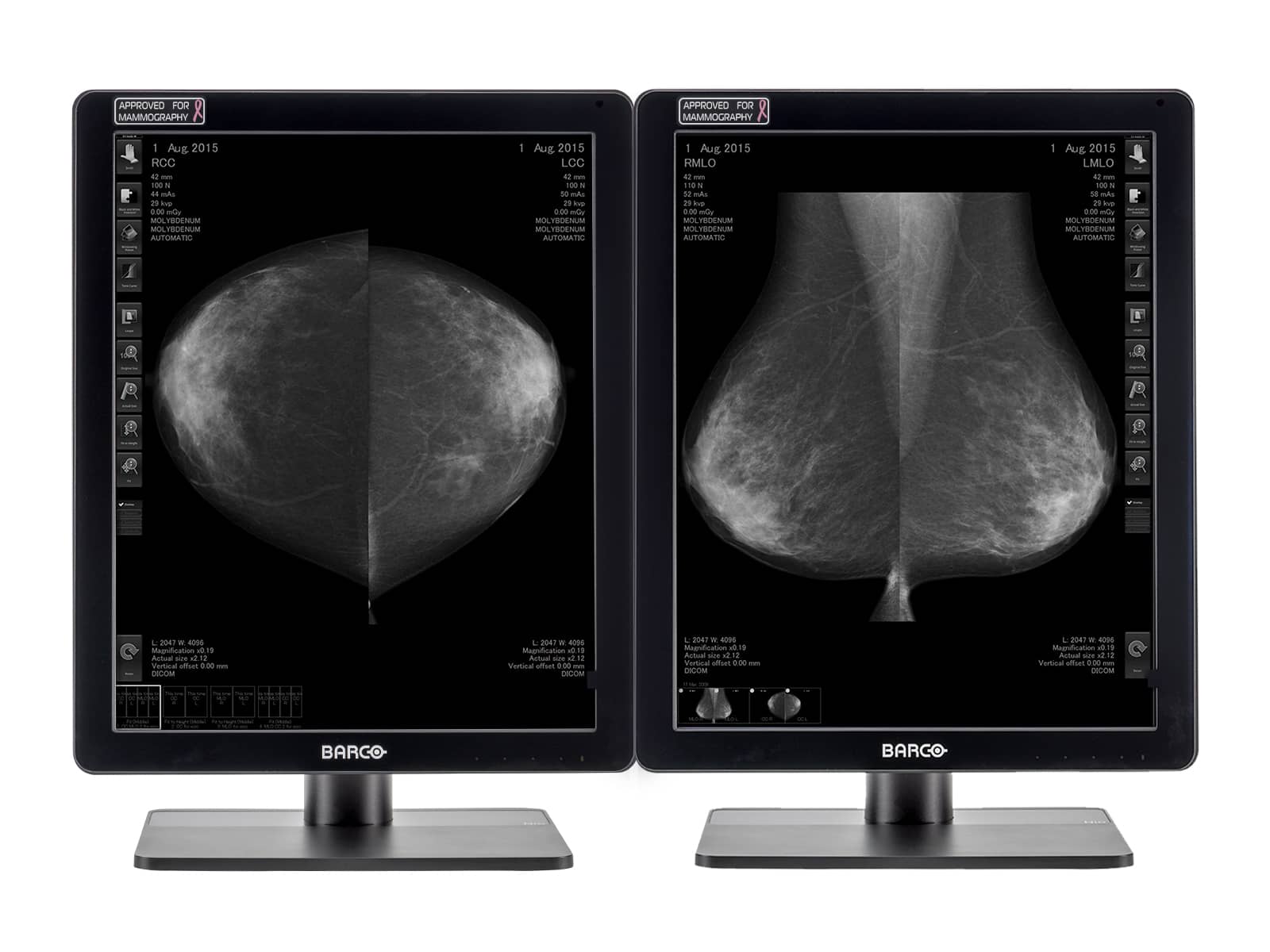Barco Écran d'imagerie mammaire Coronis MDCG-5221 LED en niveaux de gris Mammo 3D-DBT (K9301541A) Monitors.com