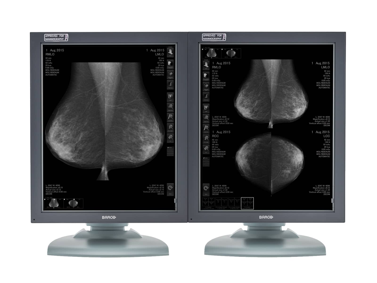 Barco Coronis MDMG-5121 Grayscale Breast Imaging PACS Mammography Display (K9601259) Monitors.com 