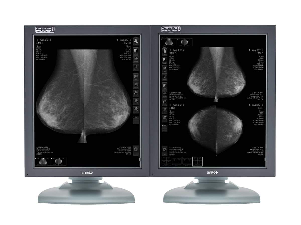 Komplette Mammographie-Lesestation | Barco 5MP-Anzeigen | HP Workstation 5121T5820R Monitore.com