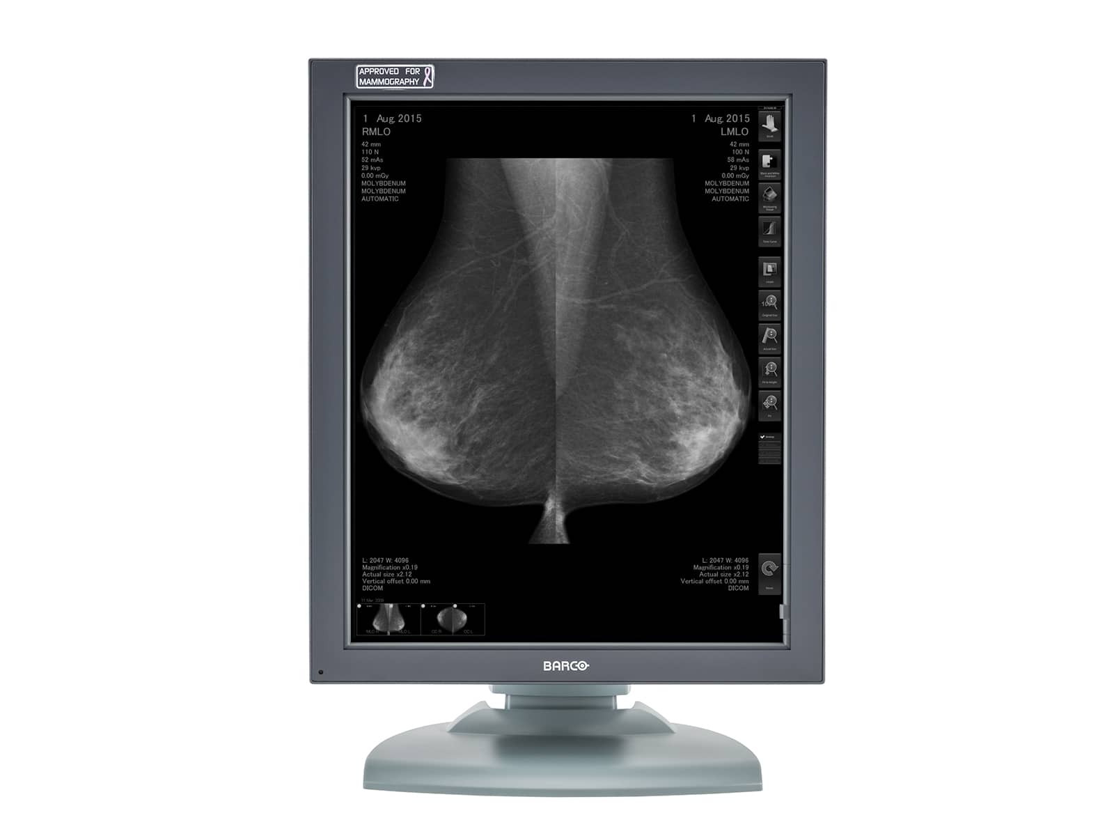 Barco Écran de mammographie PACS pour imagerie mammaire Coronis MDMG-5121 en niveaux de gris (K9601259) Monitors.com