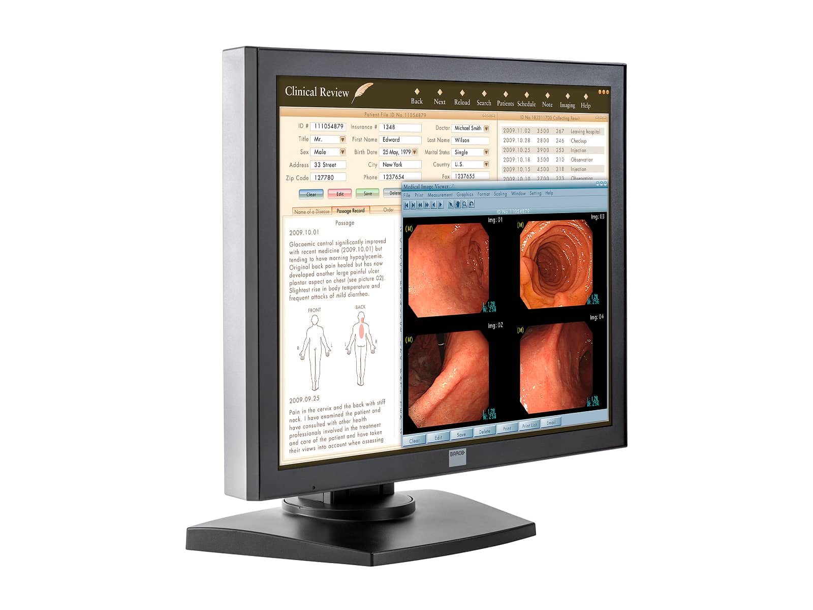 Barco MDRC-1119-TS 1MP 19-Zoll-Touchscreen-Farbdisplay für klinische Untersuchungen (K9301801A) Monitors.com
