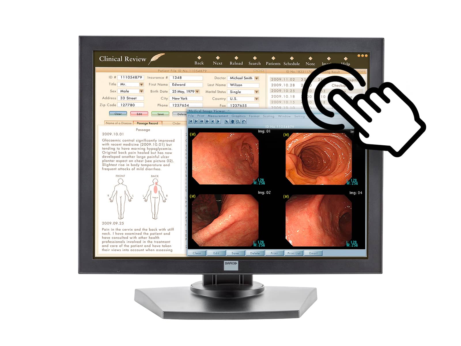 Barco MDRC-1119-TS 1MP 19 インチ タッチスクリーン カラー臨床レビュー ディスプレイ (K9301801A) Monitors.com